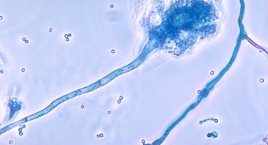 Ölümcül mantar hastalığı, küresel ısınmayla yayılabilir