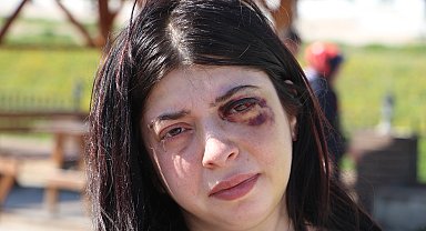 Sokak ortasında darbedilen Damla: Platinler hep yüzümde kalacakmış