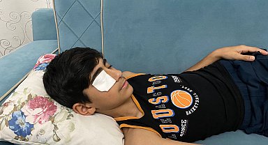 Yapıştırıcı sıçrayınca kapanan göz kapağı doktor müdahalesiyle açıldı